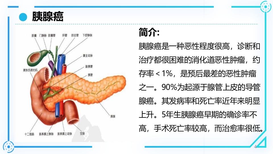 胰腺癌护理查房PPT课件4
