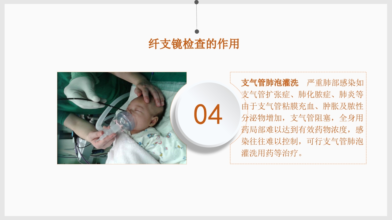 纤维支气管镜的护理PPT课件6