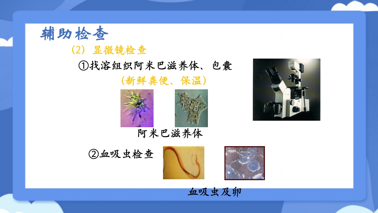 溃疡性结肠炎PPT课件19