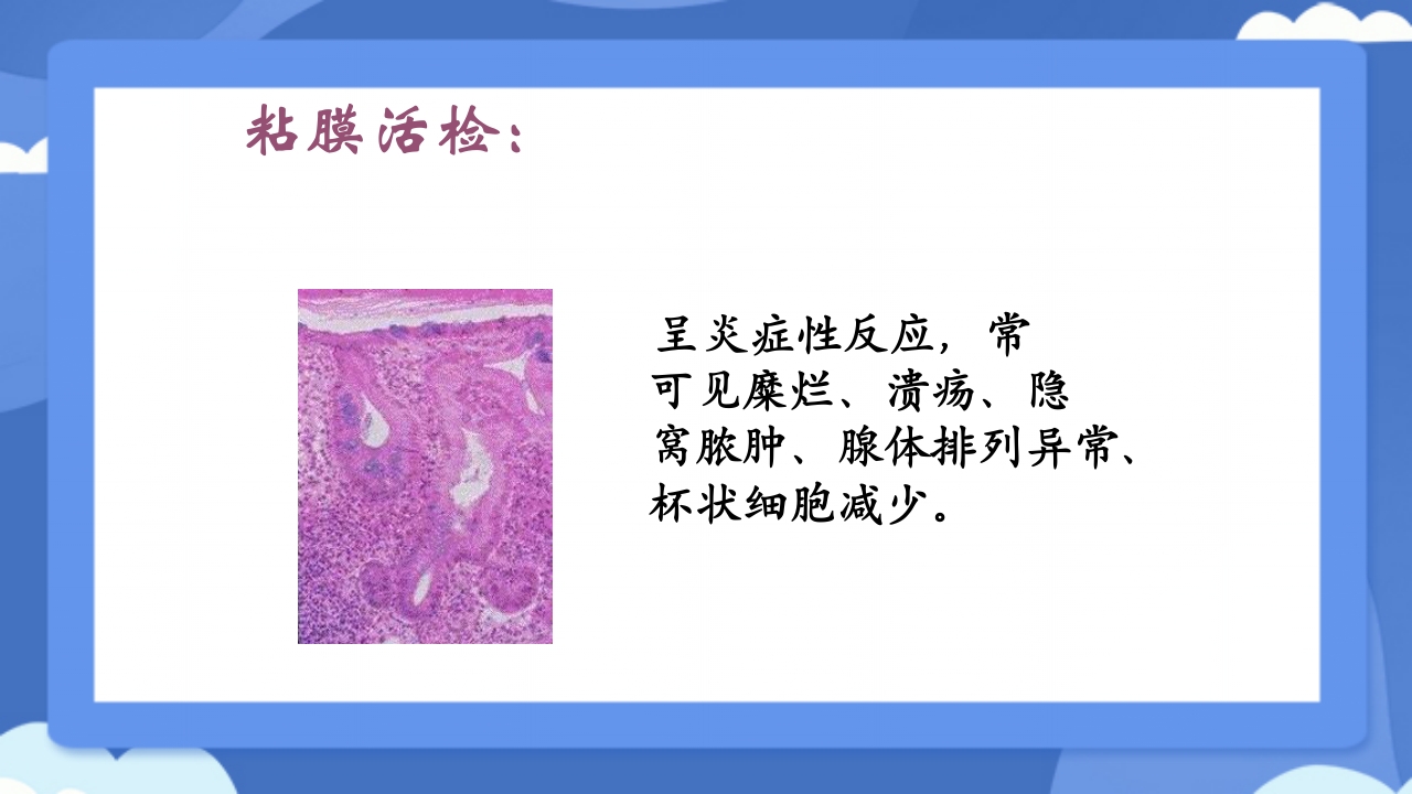 溃疡性结肠炎PPT课件24