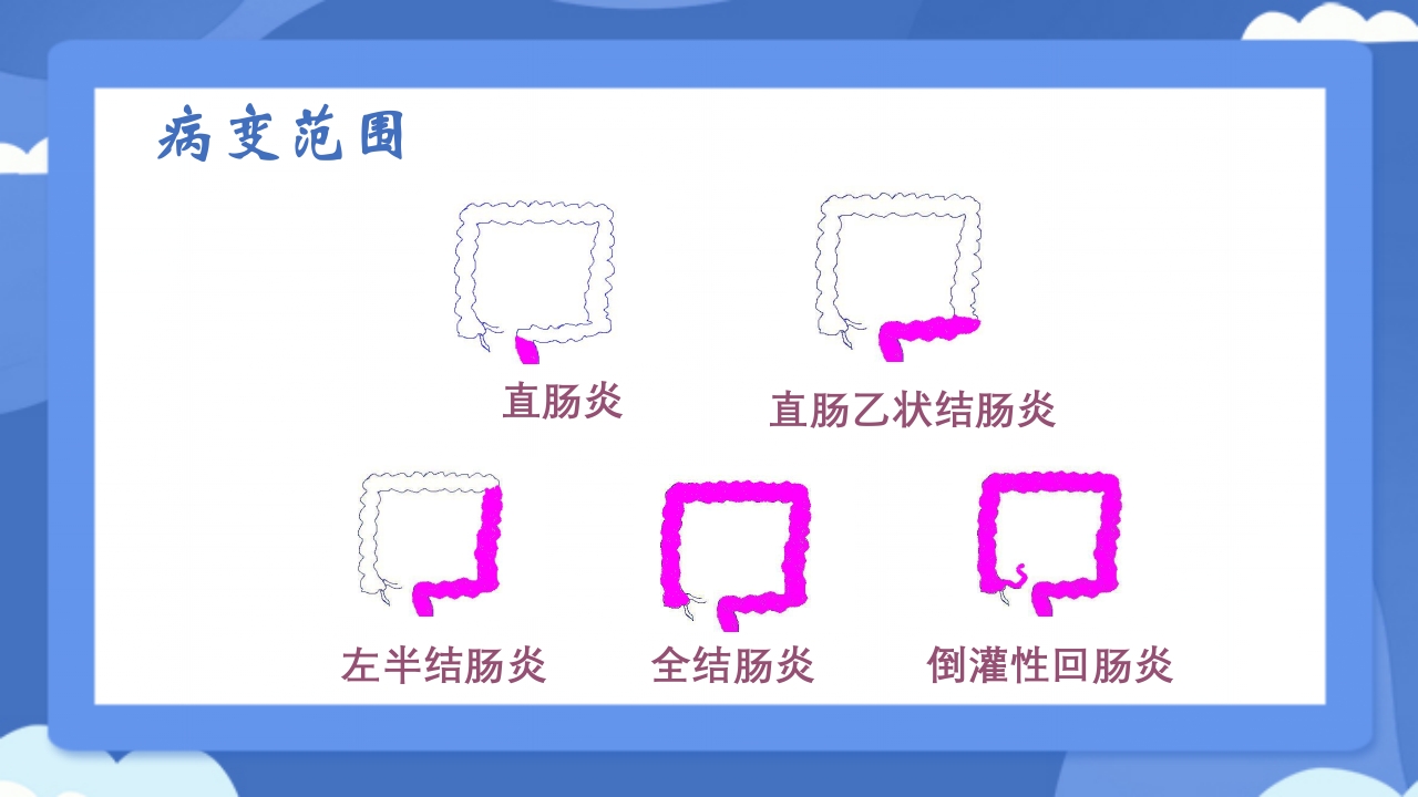 溃疡性结肠炎PPT课件37