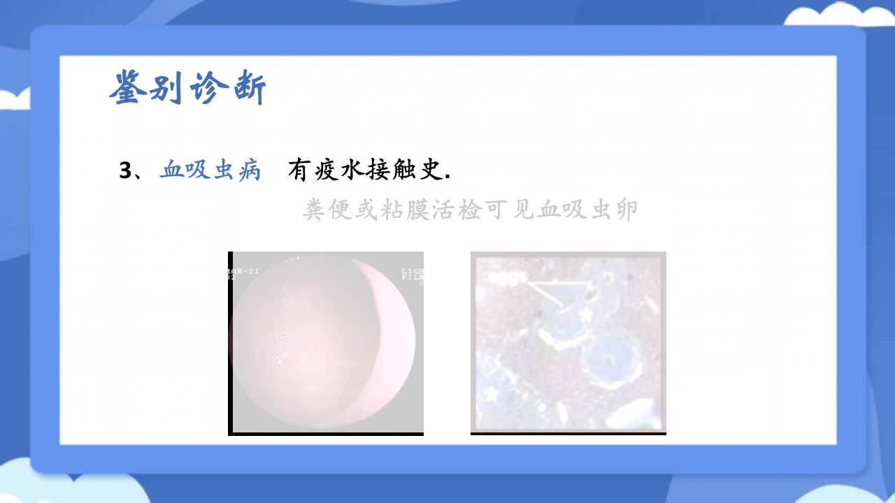 溃疡性结肠炎PPT课件40