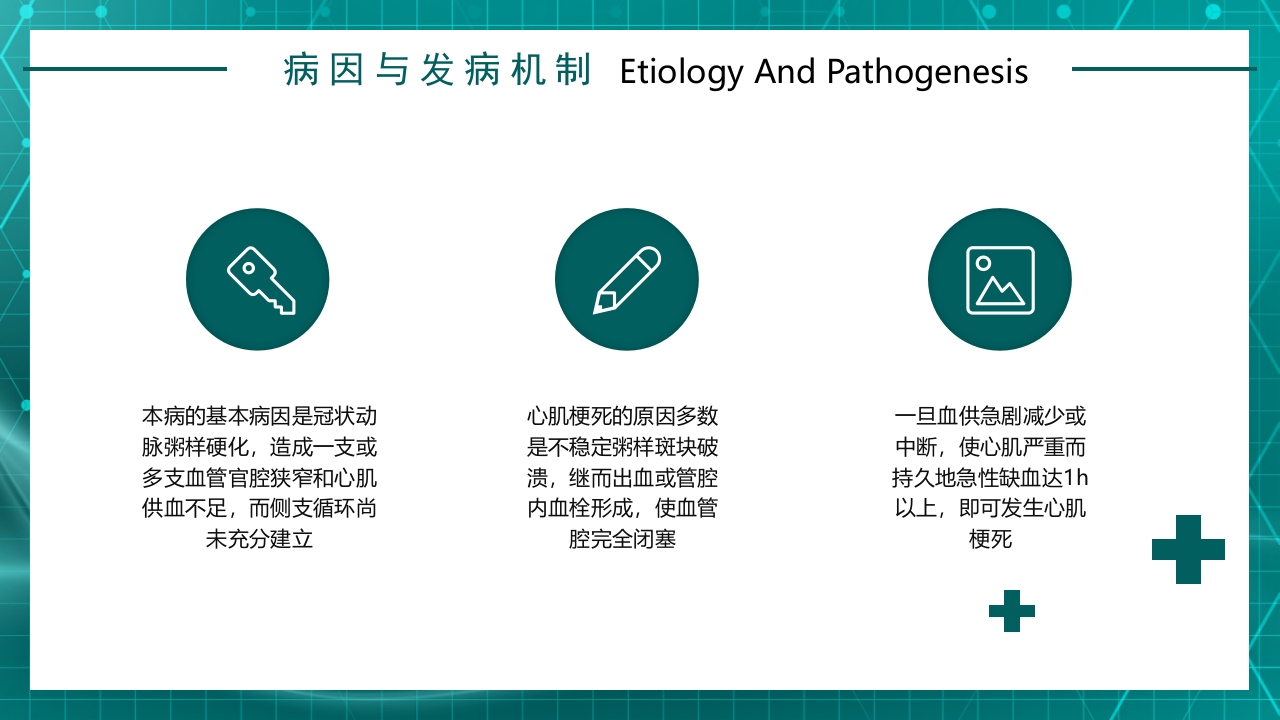 急性心梗护理查房规章知识讲座PPT课件15