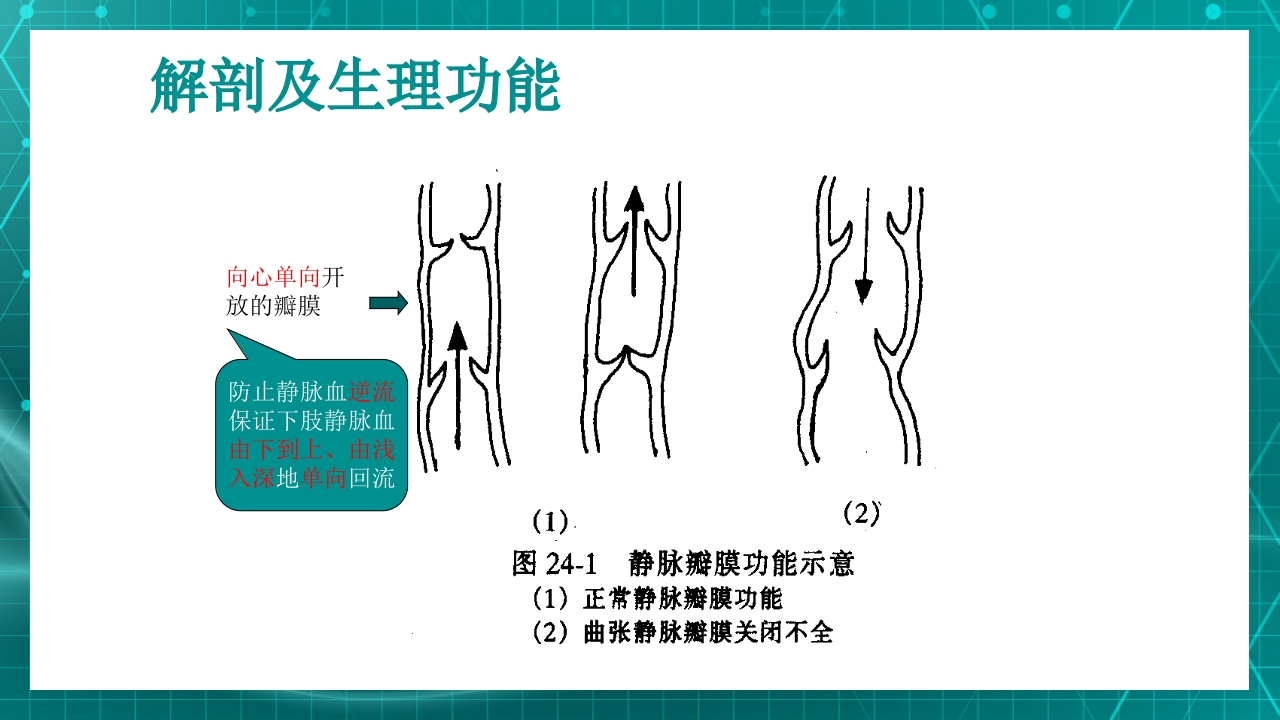 原发性下肢静脉曲张PPT课件7