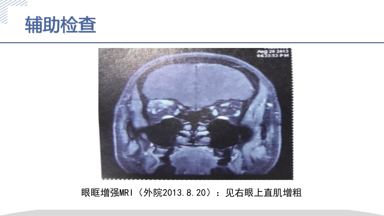 激素所致大泡视网膜脱离疑难病例讨论PPT课件10