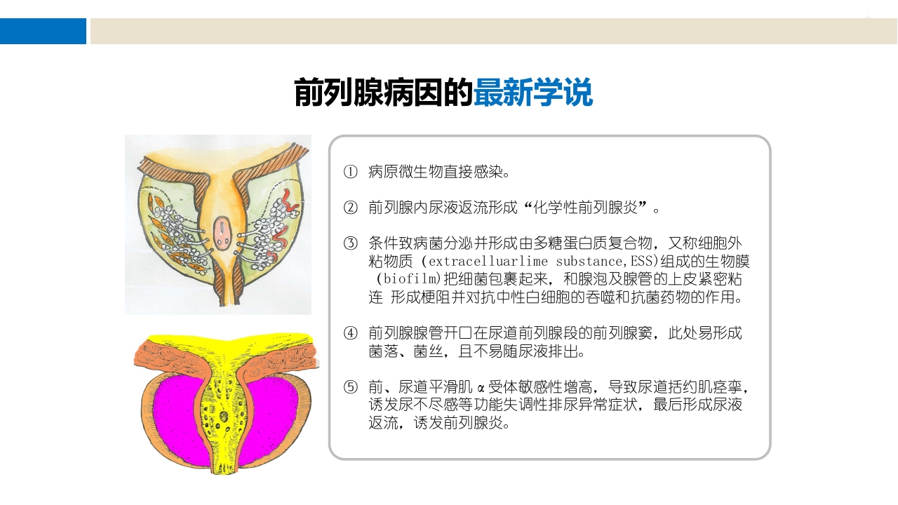 前列腺尿道注药冲洗引流导管技术ppt课件8