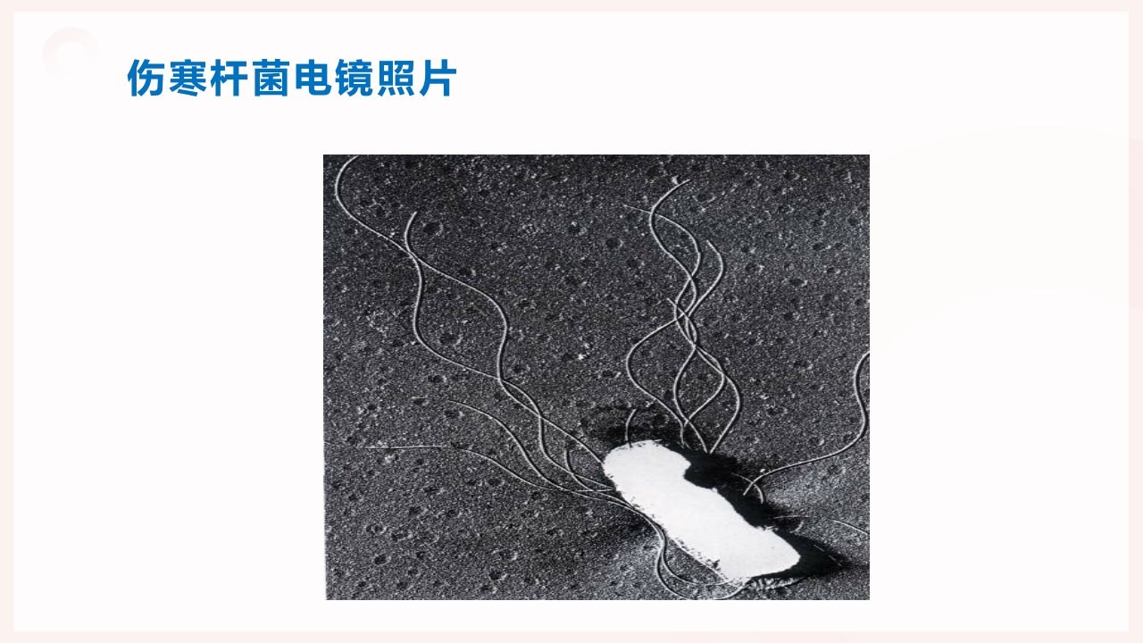 伤寒患者的护理PPT课件8