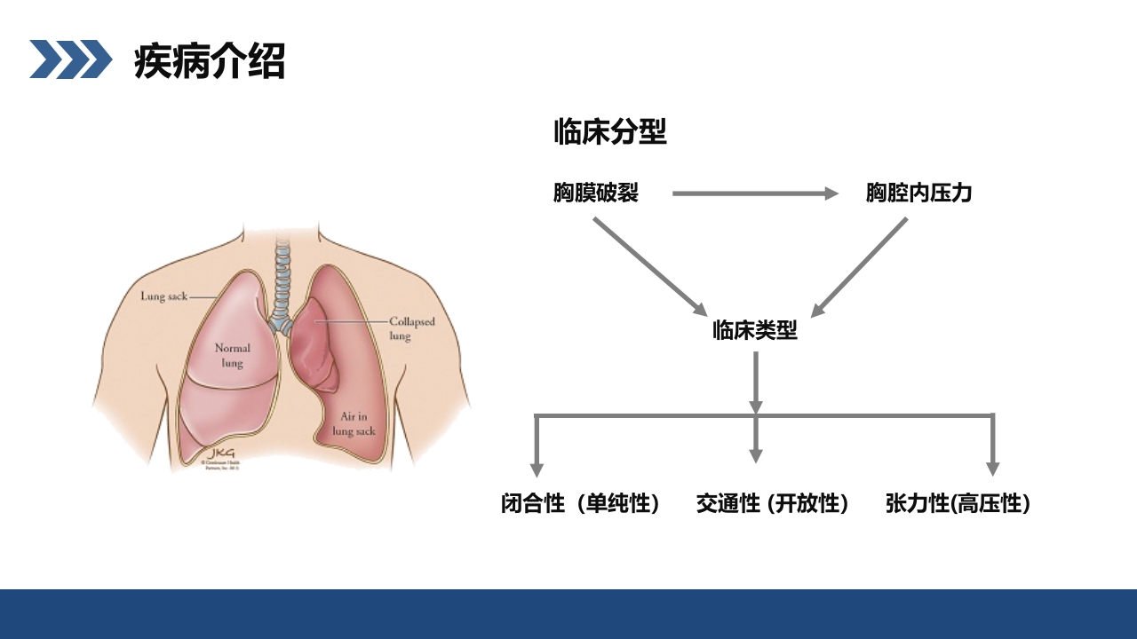 结核性胸膜炎患者护理查房PPT课件6