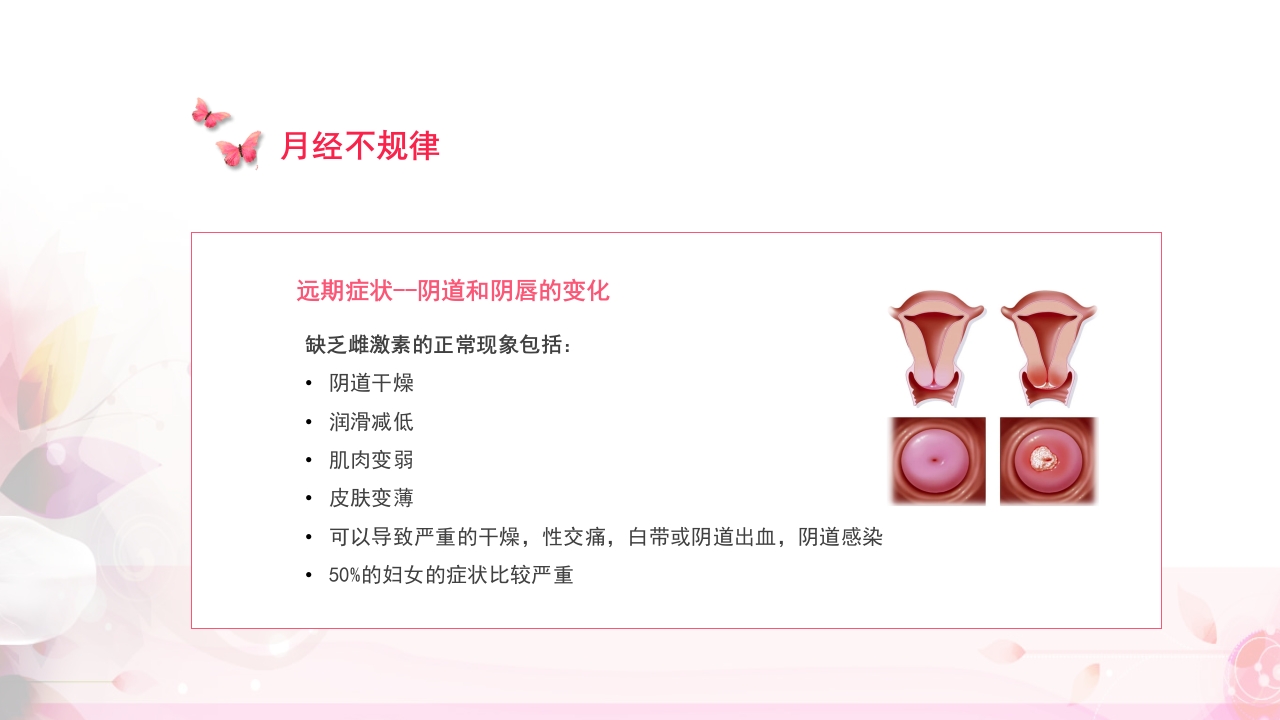 关注女性更年期健康教育ppt课件16