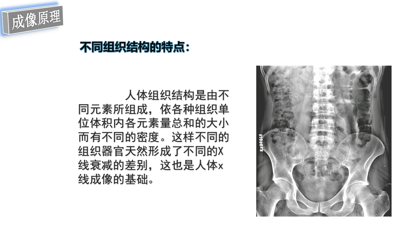 口腔影像基础PPT课件43