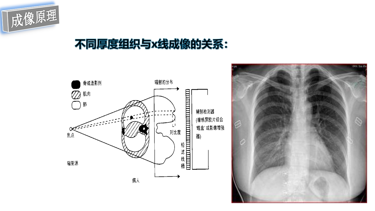 口腔影像基础PPT课件45
