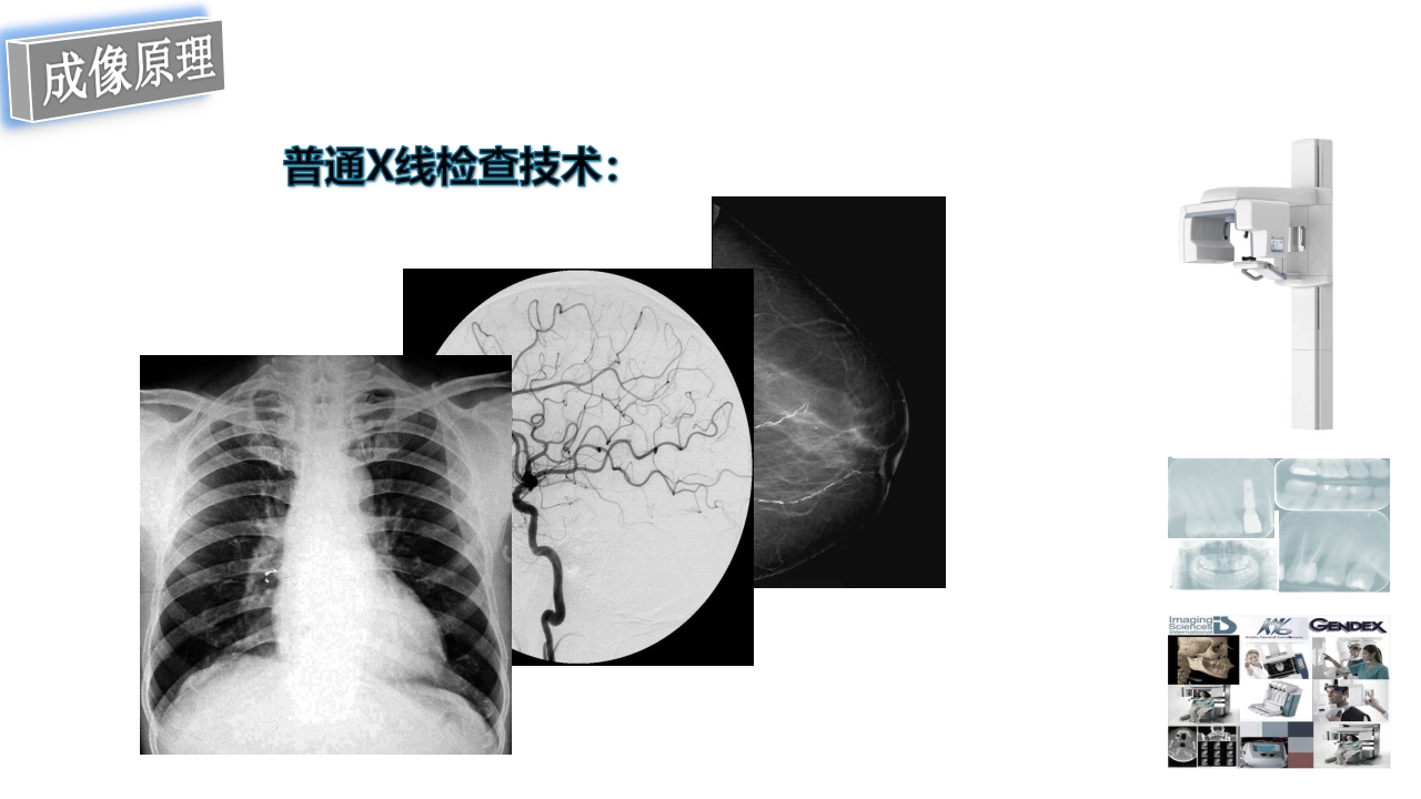 口腔影像基础PPT课件48