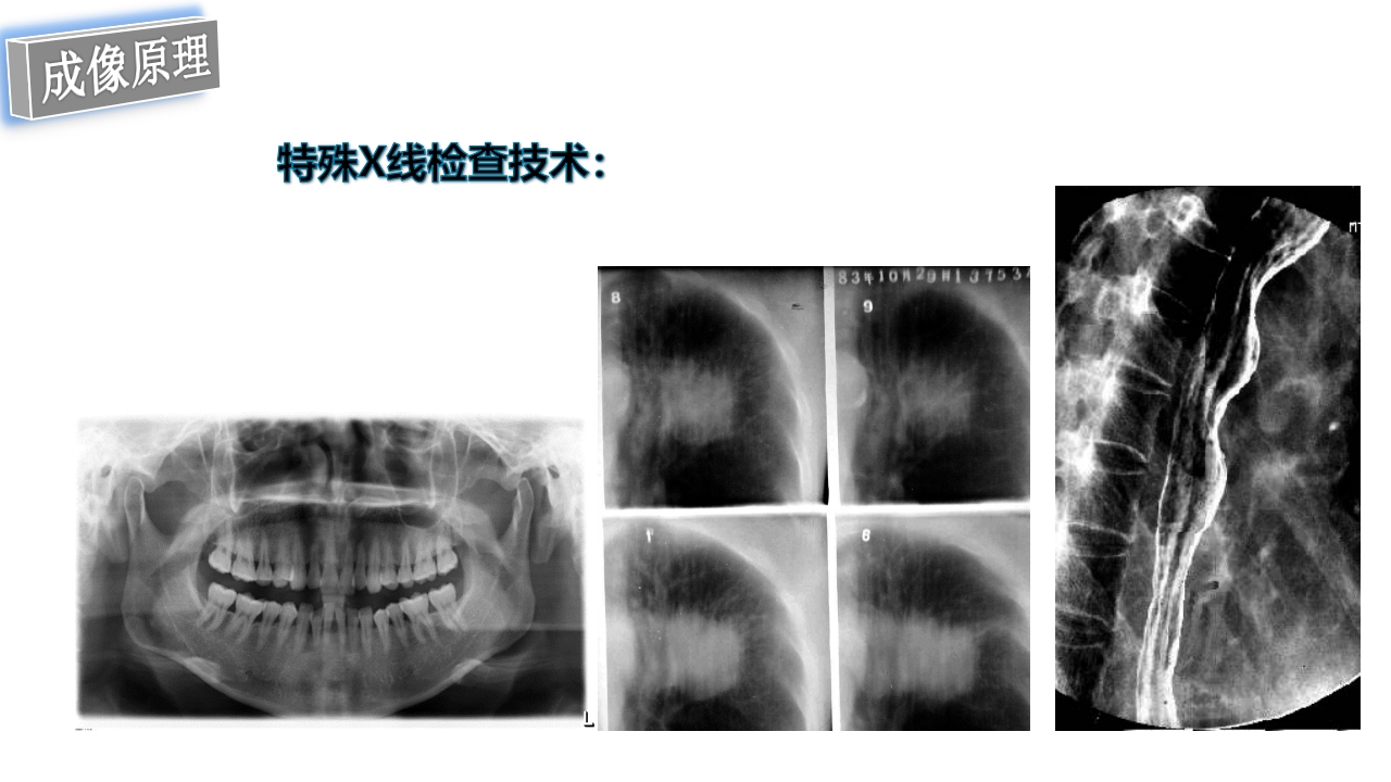 口腔影像基础PPT课件50