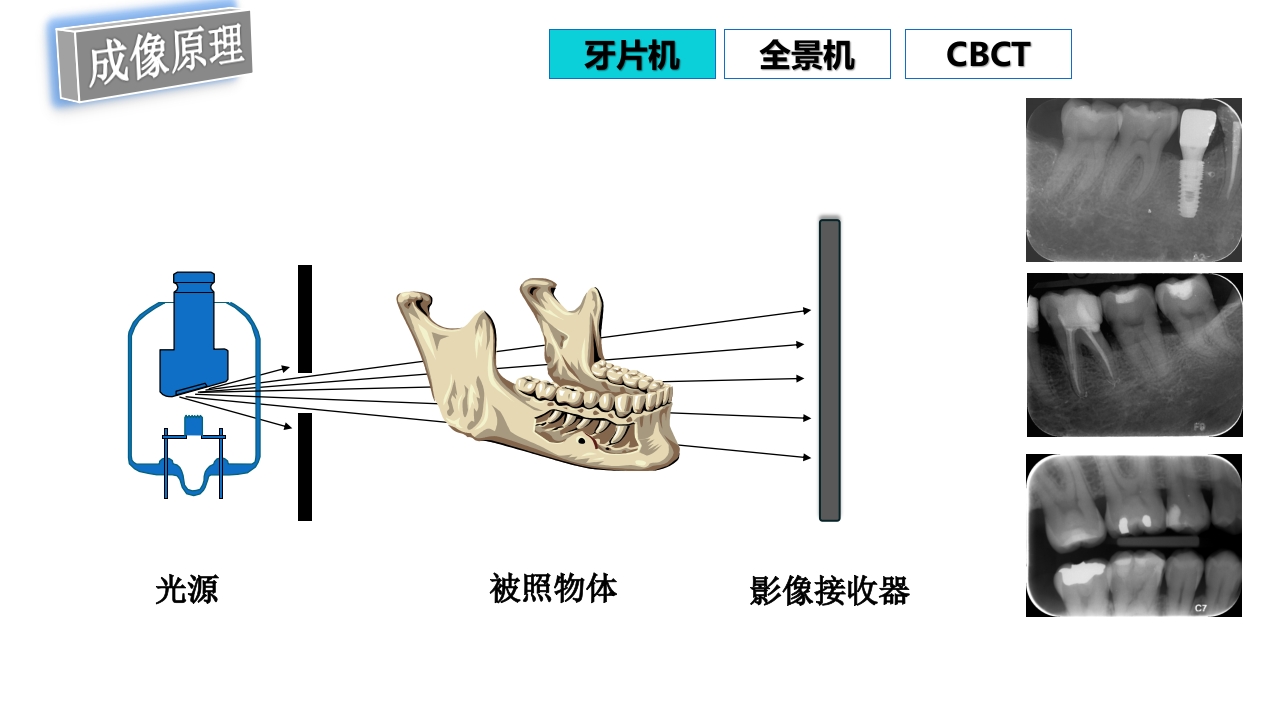 口腔影像基础PPT课件53