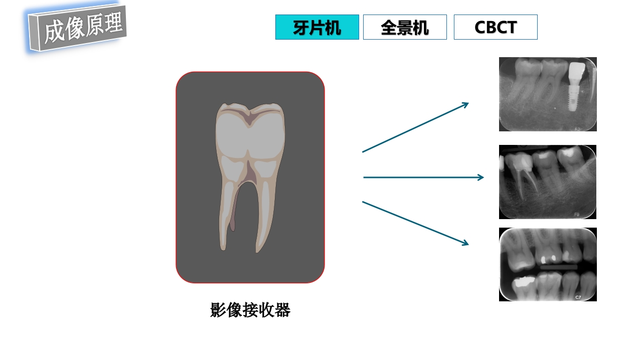 口腔影像基础PPT课件54