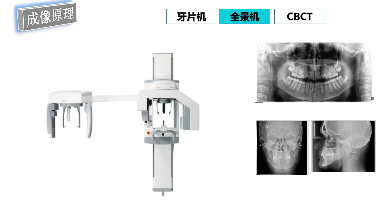 口腔影像基础PPT课件61