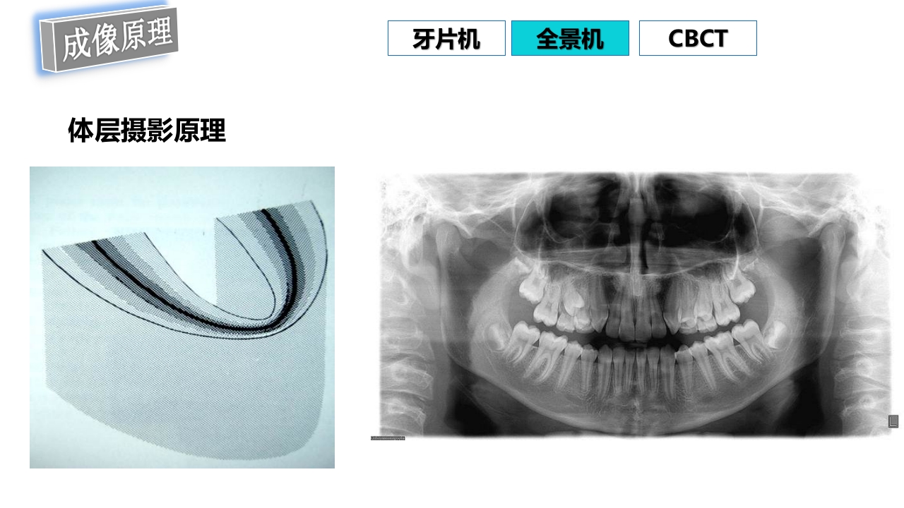口腔影像基础PPT课件63