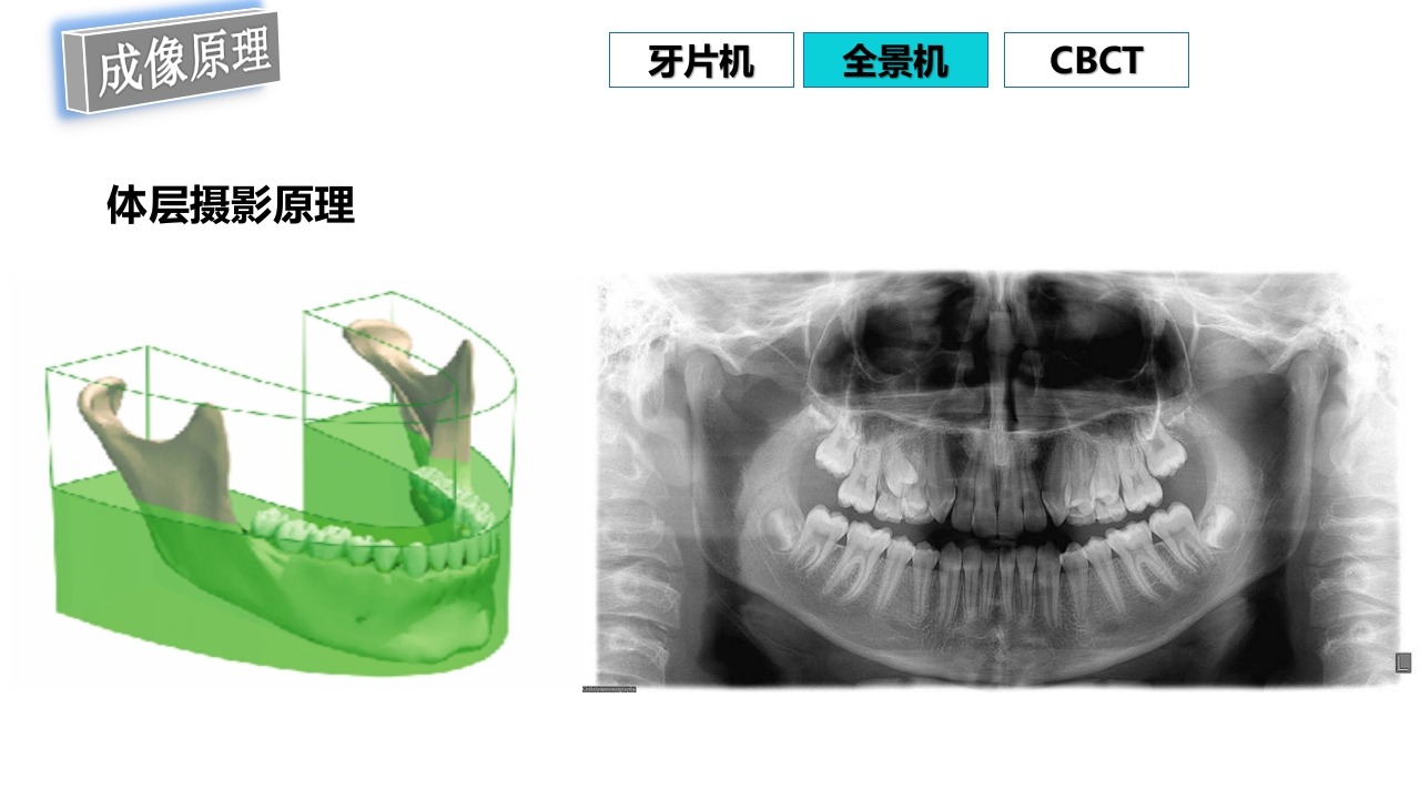 口腔影像基础PPT课件64