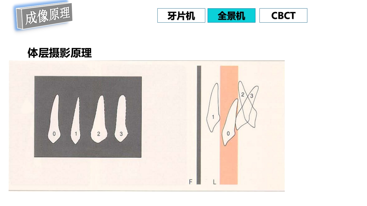 口腔影像基础PPT课件65