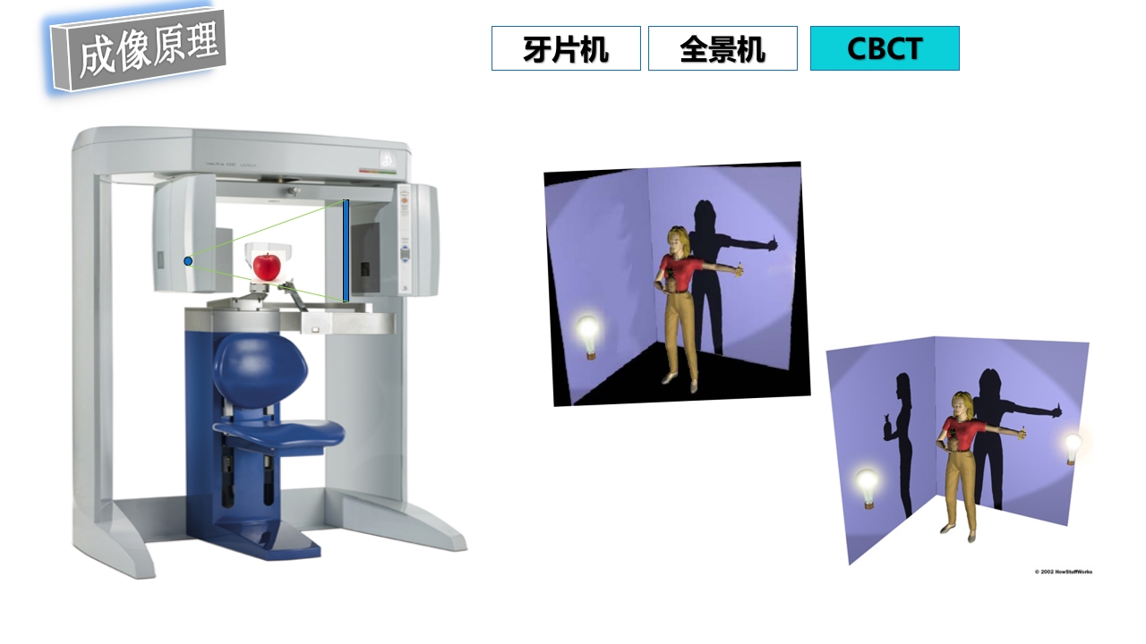 口腔影像基础PPT课件70
