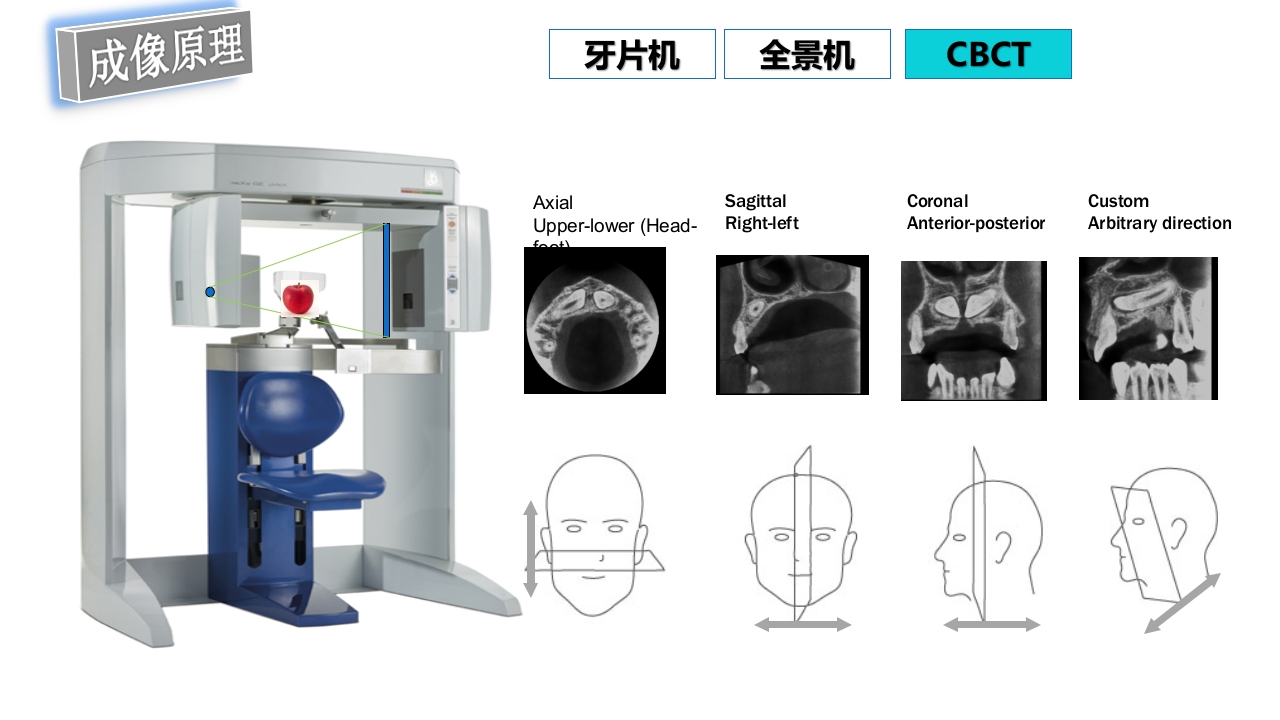 口腔影像基础PPT课件71