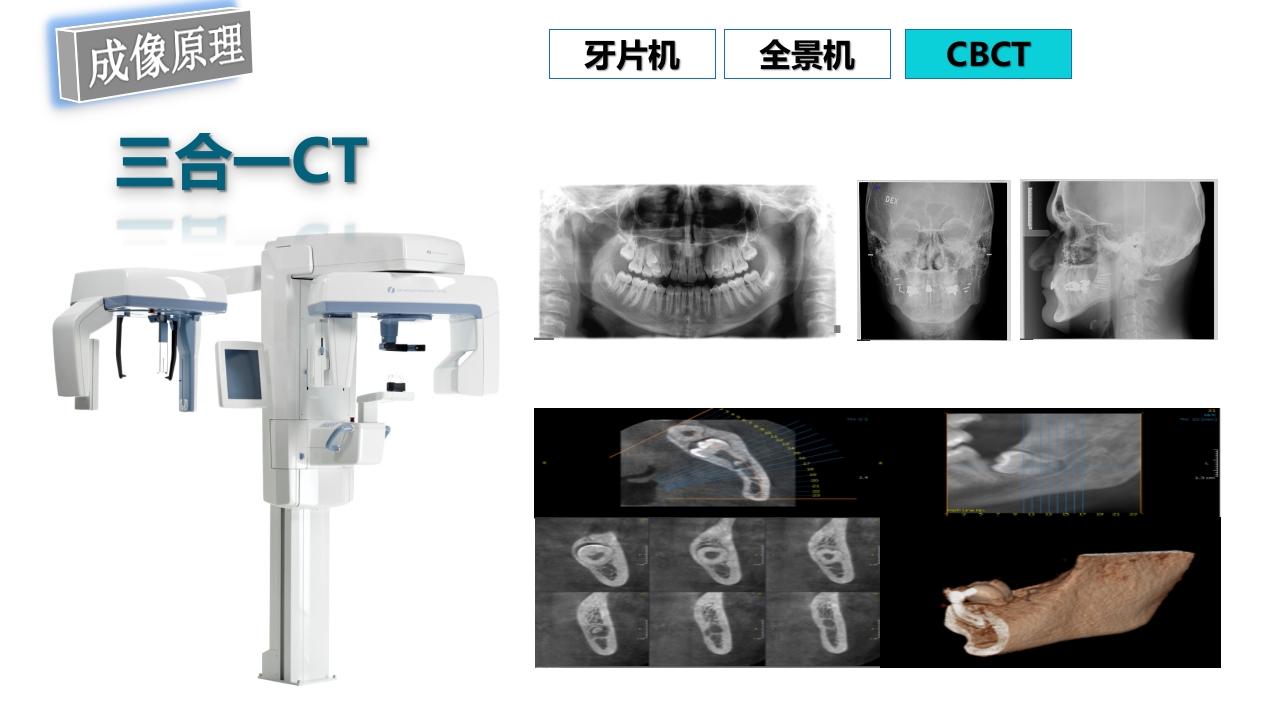 口腔影像基础PPT课件72