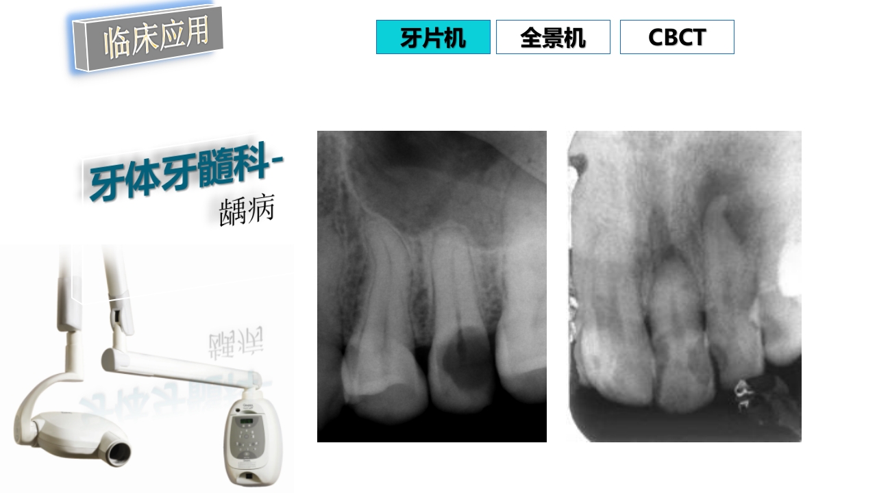 口腔影像基础PPT课件75