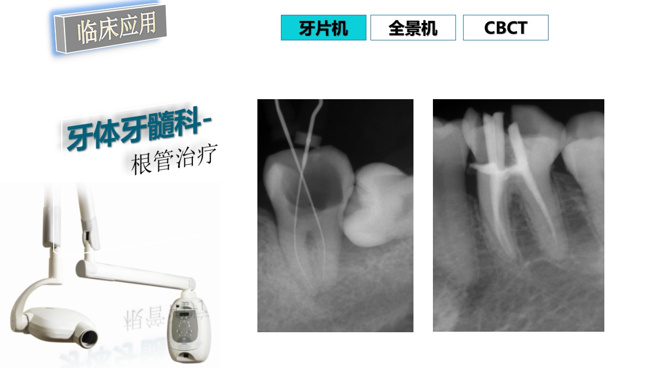 口腔影像基础PPT课件76