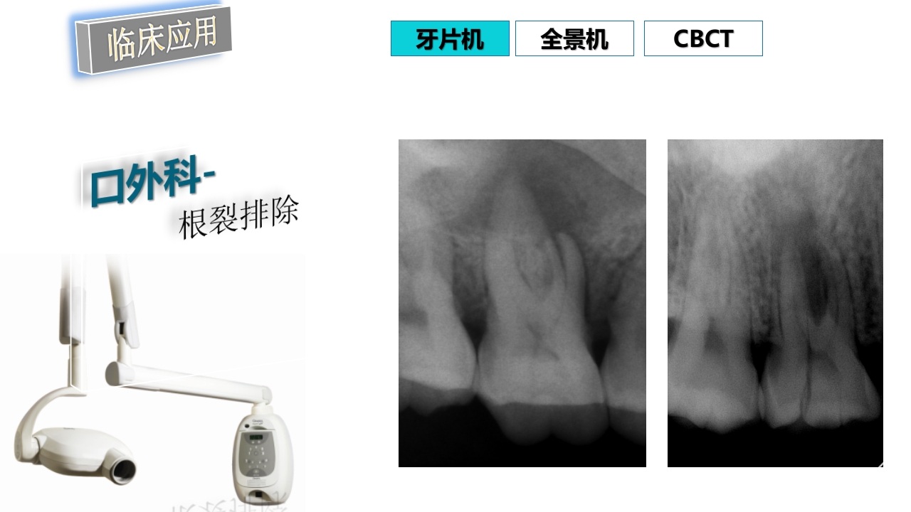 口腔影像基础PPT课件77
