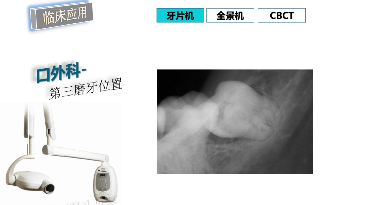口腔影像基础PPT课件78