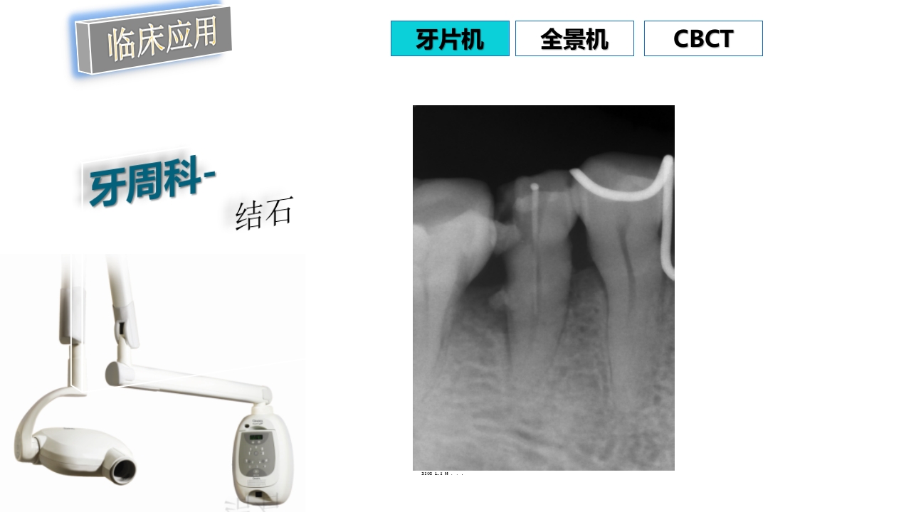 口腔影像基础PPT课件79