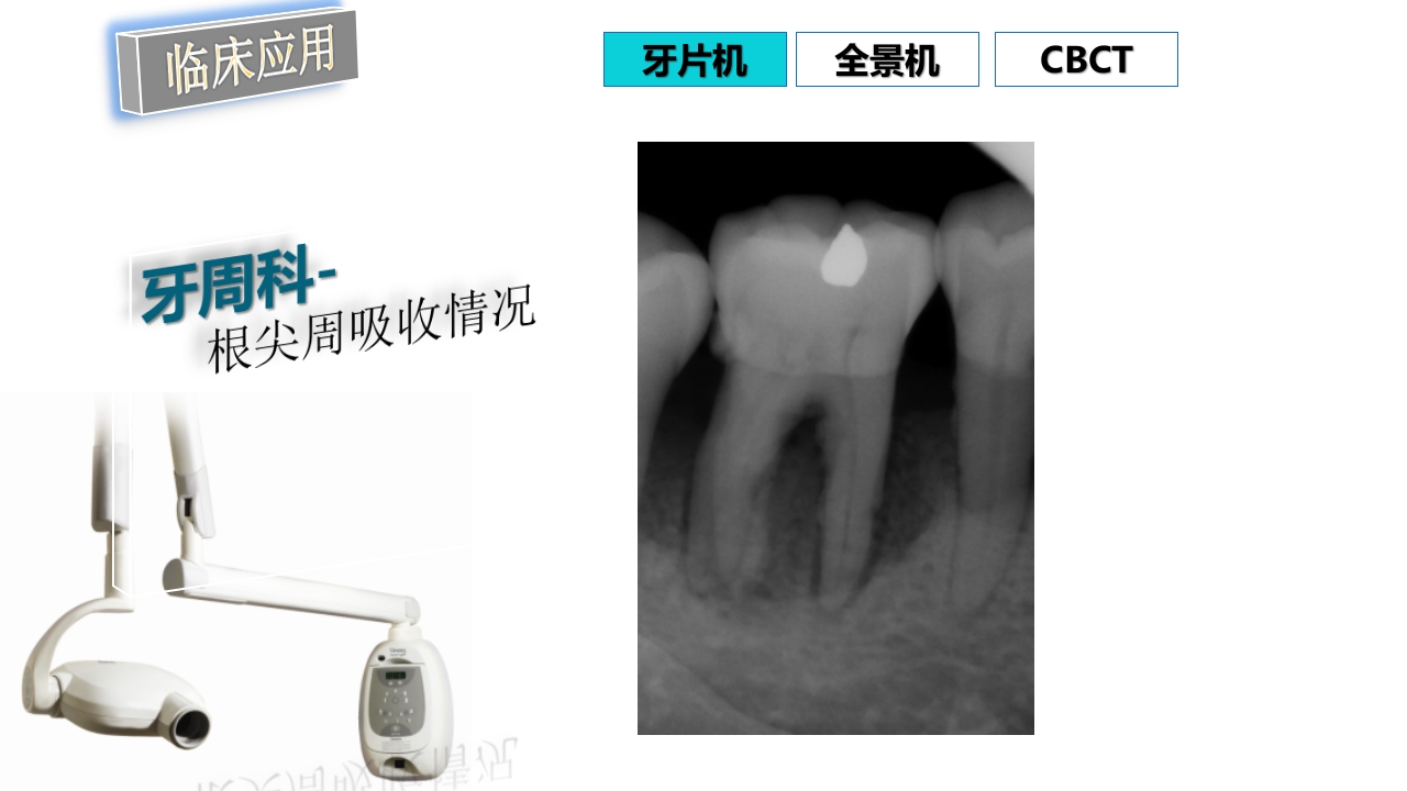 口腔影像基础PPT课件80