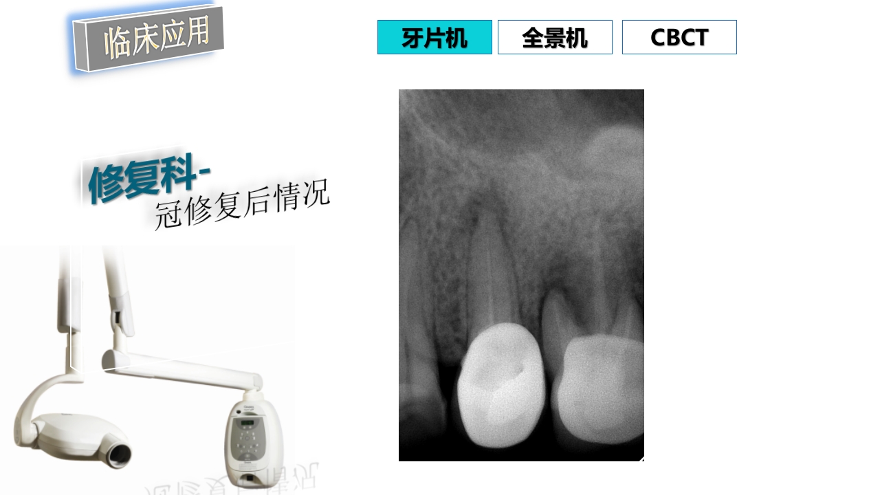 口腔影像基础PPT课件81