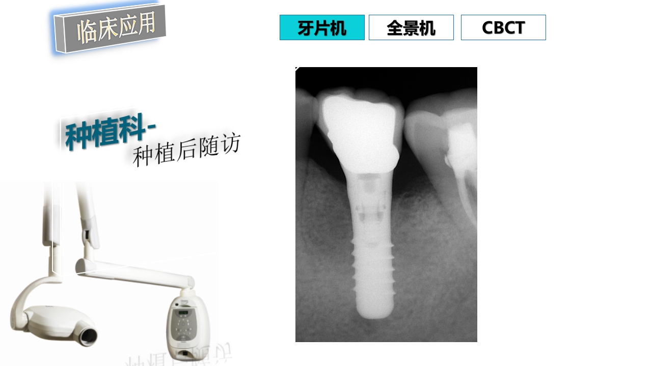口腔影像基础PPT课件82