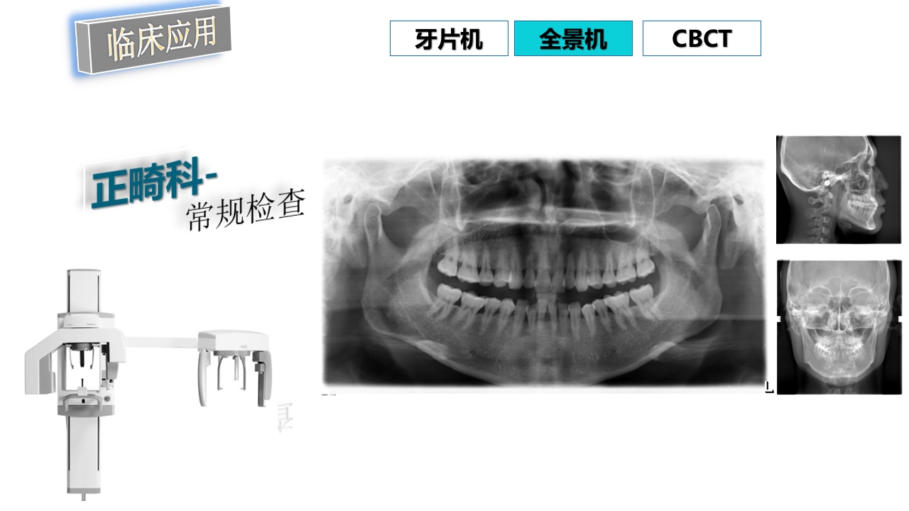 口腔影像基础PPT课件84