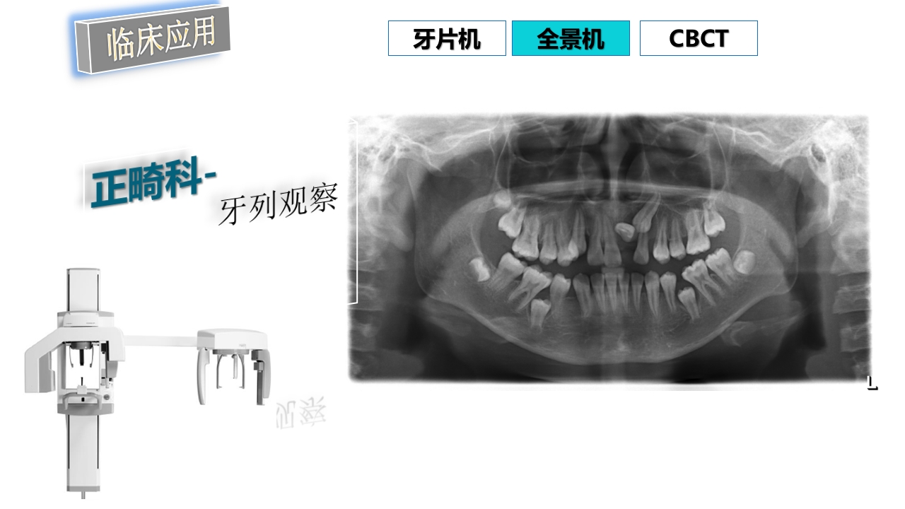 口腔影像基础PPT课件85