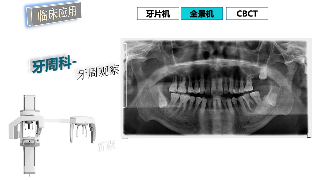 口腔影像基础PPT课件86