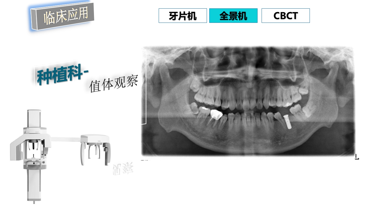 口腔影像基础PPT课件87