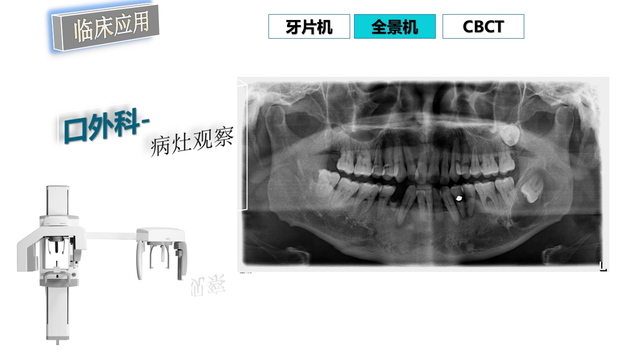 口腔影像基础PPT课件88
