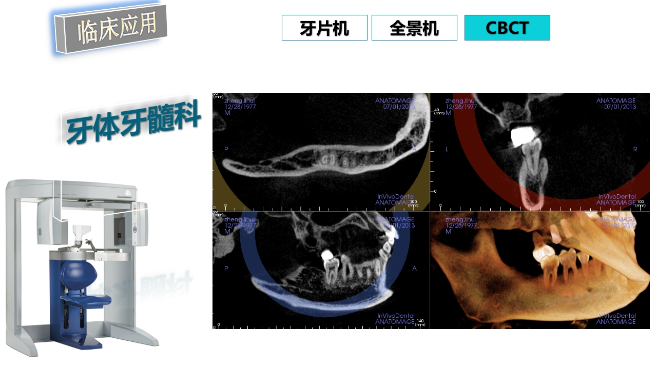 口腔影像基础PPT课件89