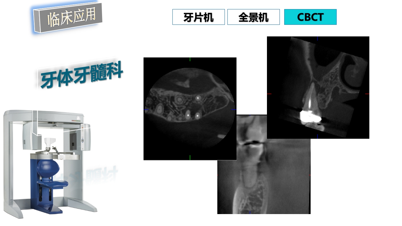 口腔影像基础PPT课件90
