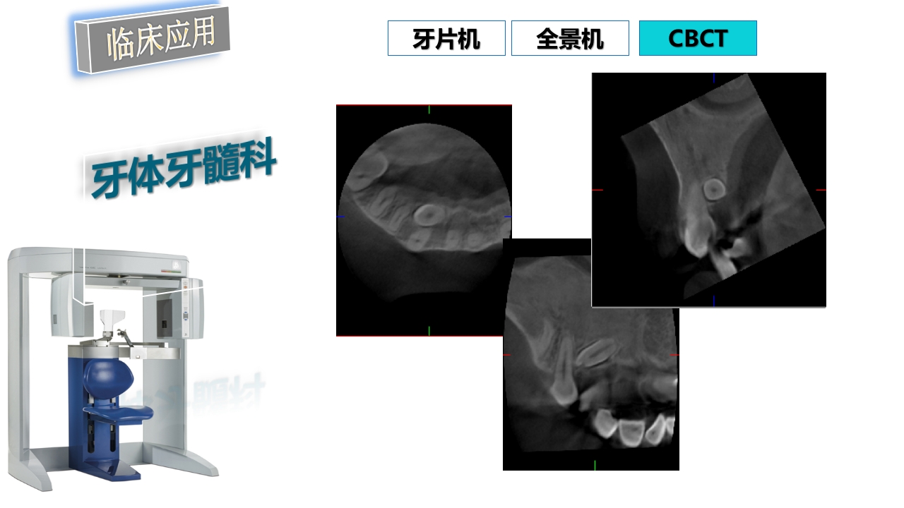 口腔影像基础PPT课件91