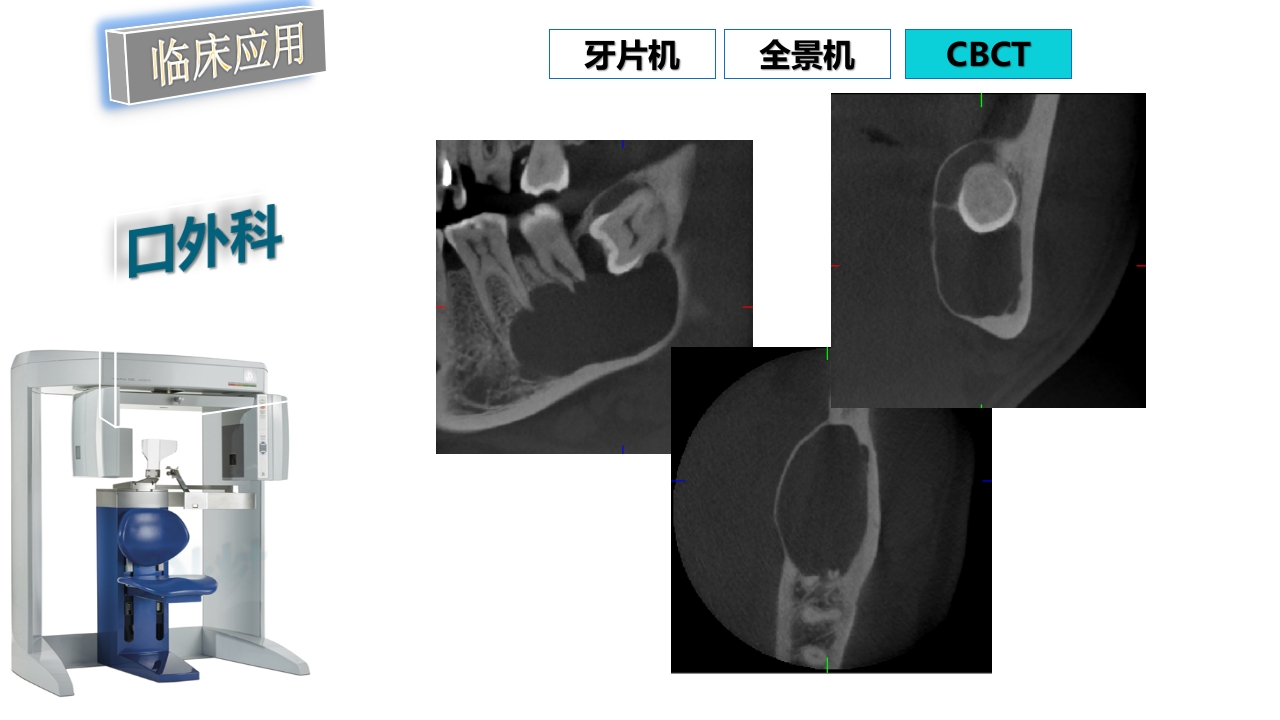 口腔影像基础PPT课件92