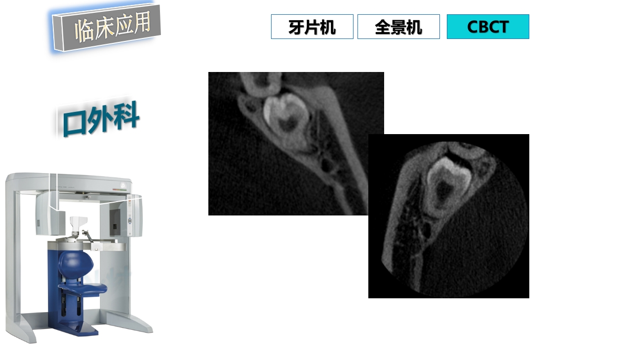 口腔影像基础PPT课件93