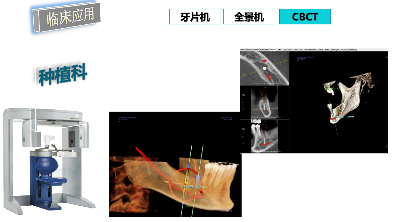 口腔影像基础PPT课件94