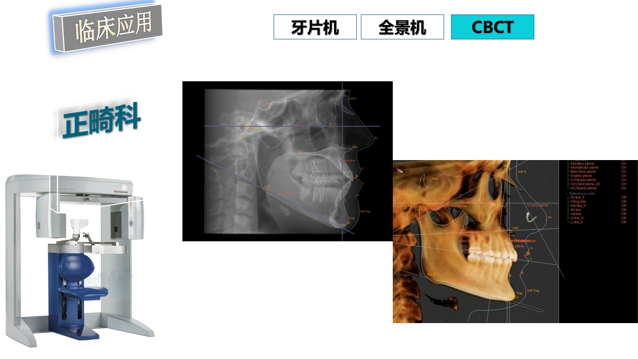 口腔影像基础PPT课件95