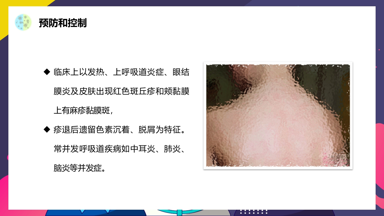 春夏季常见传染病预防知识PPT课件20