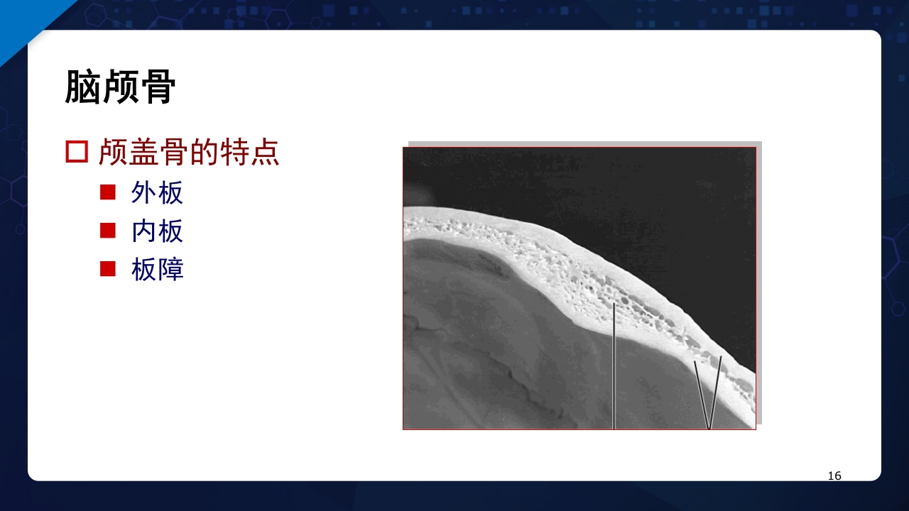 人体解剖学运动系统PPT课件16