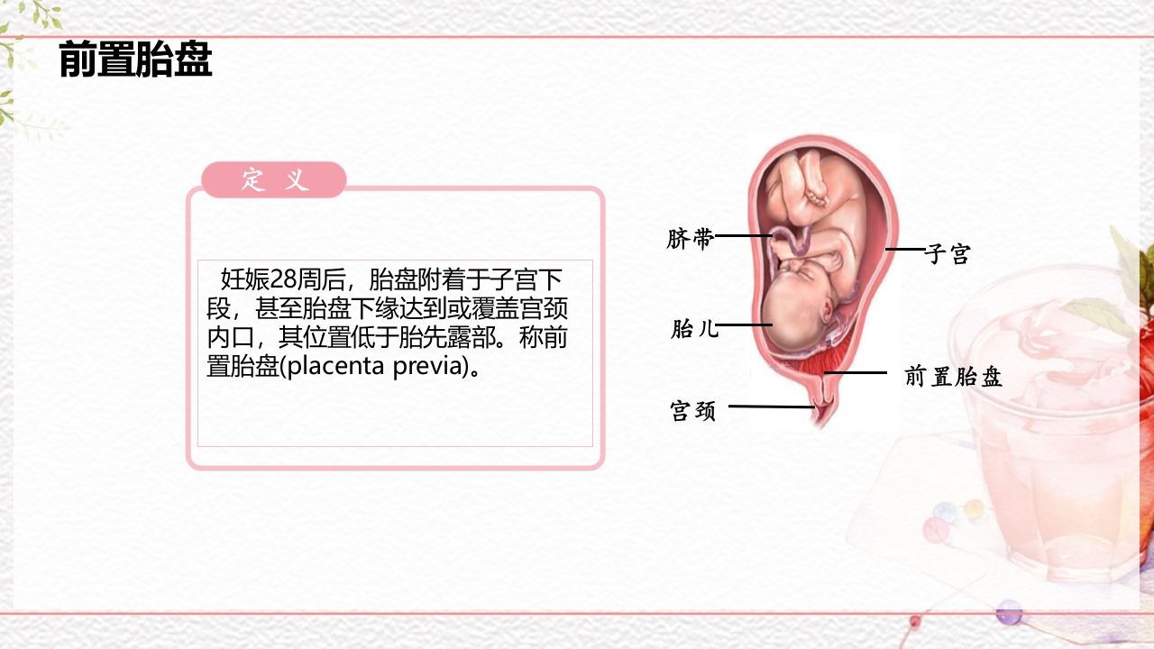 一例介入联合子宫全切救治的并立讨论PPT课件8