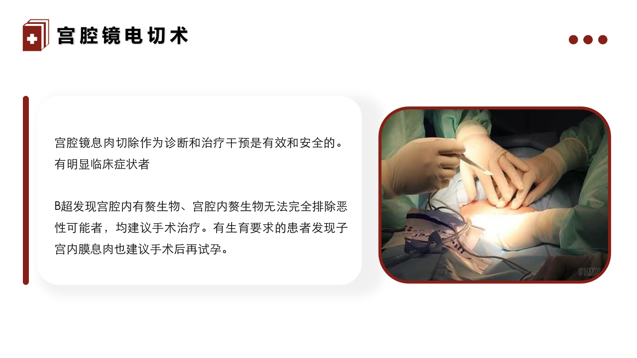 子宫内膜息肉的护理PPT课件14